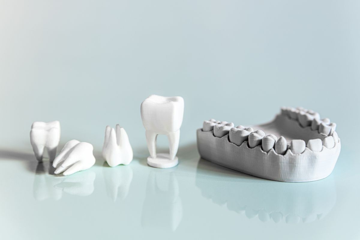 La Fijación de Prótesis Dental: Transformando Sonrisas en Clínica Montecarmelo