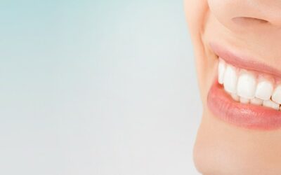 Blanqueamiento dental: 3 cosas que debes saber sobre este tratamiento