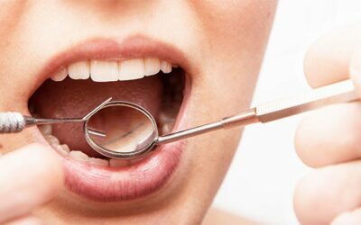 3 consejos para evitar la periodontitis
