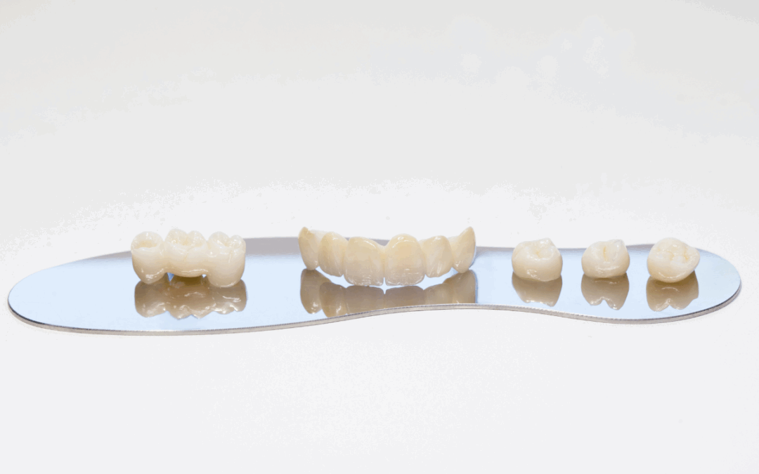 Coronas de Zirconio: Cómo recuperar tu sonrisa