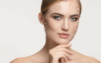Descubre las principales diferencias entre Ellansé™ y Radiesse™