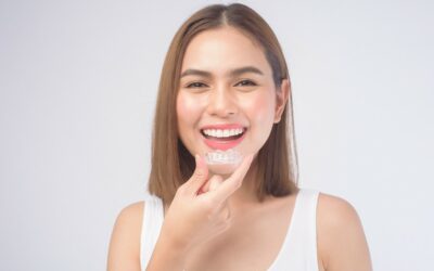 Guía rápida sobre retenedores dentales y cómo usarlos