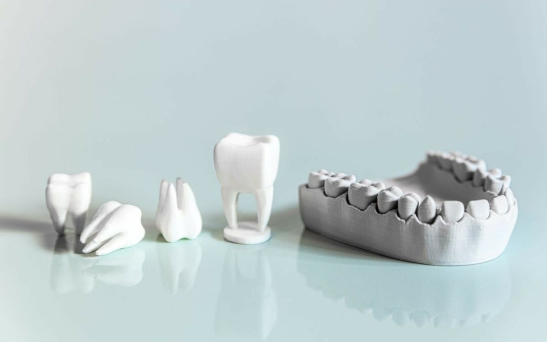 La Fijación de Prótesis Dental: Transformando Sonrisas en Clínica Montecarmelo