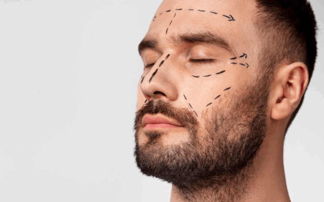Masculinización facial: resultados y consideraciones