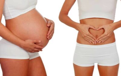 Que es el ‘mommy makeover’ y porque esta tan de moda