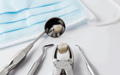 ¿Qué es una exodoncia y cuando es recomendable para nuestra salud bucal?
