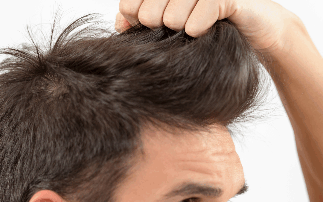 Salud Capilar Moderna: Tratamientos que Frenan la Caída y Recuperan la Densidad