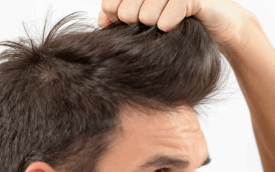 Salud Capilar Moderna: Tratamientos que Frenan la Caída y Recuperan la Densidad